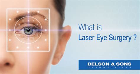 laser eye surgery    work belson opticians
