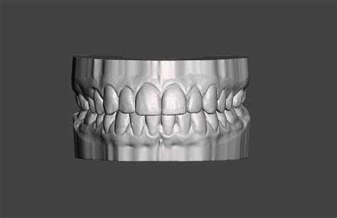 stl file dental model mouth teethd printer design  downloadcults