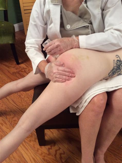 the clinical approach spanking and enema play