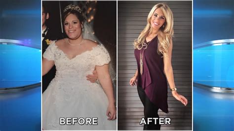 woman s incredible 113 pound weight loss without surgery