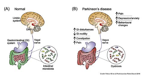 insights   role  gut microbiota  parkinsons disease