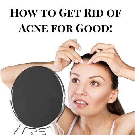 rid  acne quickly  good  complete list  tips
