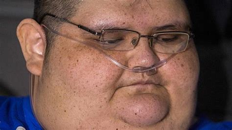 Obese Mexican Man Juan Pedro Franco Removed From Home Herald Sun