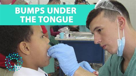 bumps   tongue symptoms  youtube