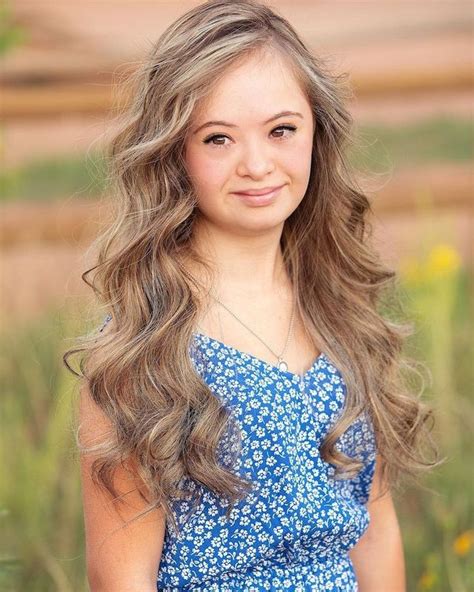 teen model with down syndrome is breaking barriers with