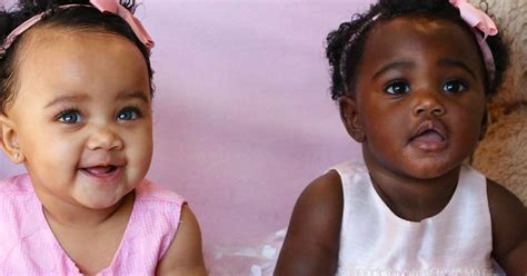 Mom Shares Photos Of Her Twins With Different Skin Colors