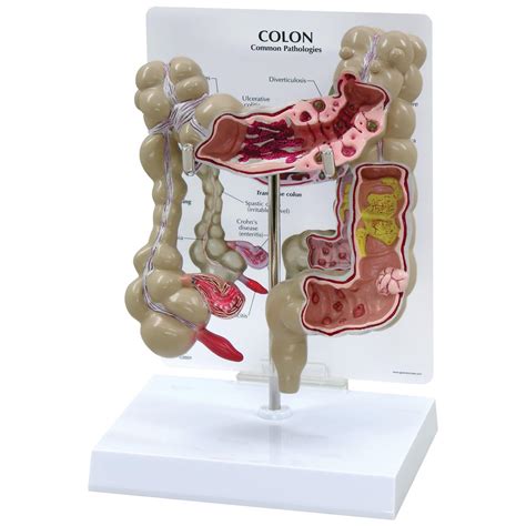 Colon Model 1019554 W33364 3340 Anatomical Models Anatomy