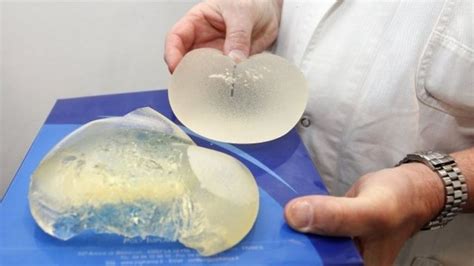 New Register For Breast Implants In England Bbc News