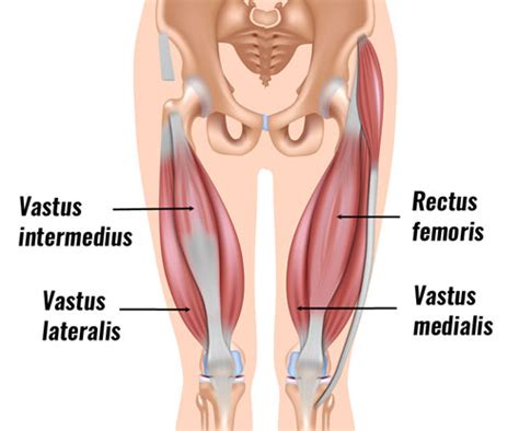 thigh muscle strain quad strain treatment rehabilitation exercises