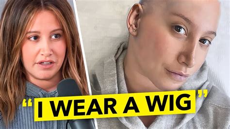 Ashley Tisdale Opens Up About Her Struggles With Alopecia Youtube