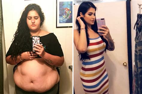 how to lose weight mum loses 16 5st with this weight loss surgery