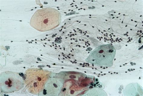 cervical smear containing sperm photograph by dr e walker fine art