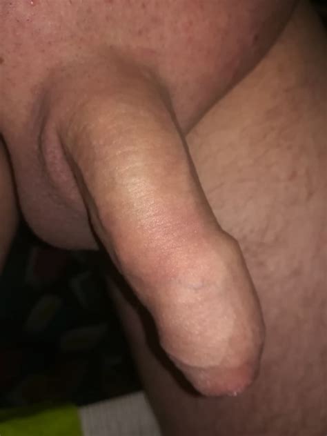 uncircumcised penis 1769 pics