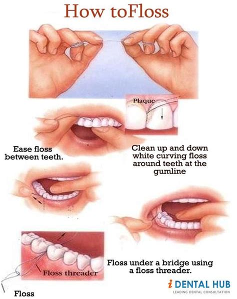 clean   dental bridge brendonbuchler