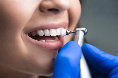professionelle zahnreinigung zahnarztpraxis lange muenchen