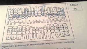 dental charting