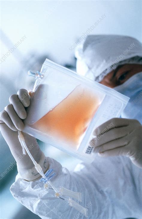 cell therapy stock image  science photo library
