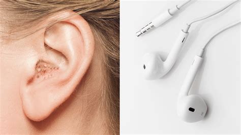 doctors warn      ears   wear headphones
