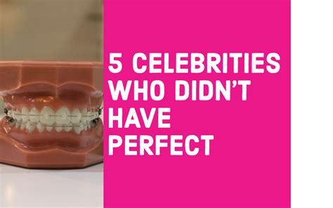 5 Celebrities Who Didn T Have Perfect Teeth Dental Office Training By