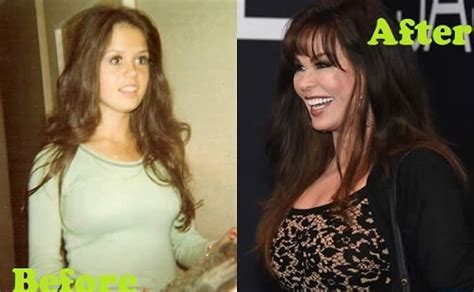 marie osmond plastic surgery before and after pictures comparison glamour path
