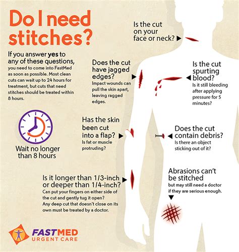 stitches infographic explanation fastmed