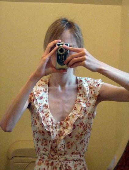 Anorexic Girls ~ Damn Cool Pictures