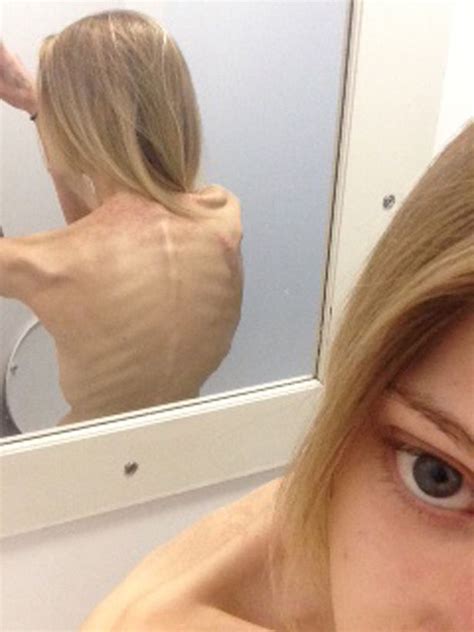 thinspiration selfies almost killed me anorexia survivor s warning as mirror investigation