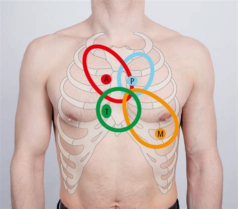 Heart Auscultation Signs And Symptoms Mcmaster Textbook Of Internal