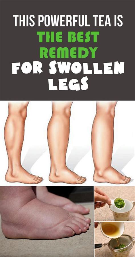 remedies for swollen feet this powerful tea is the best remedy for