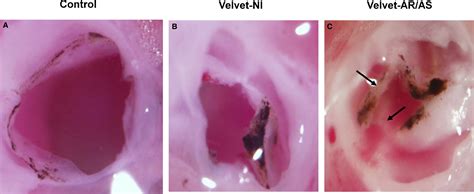 Discovery Of An Experimental Model Of Unicuspid Aortic Valve Journal