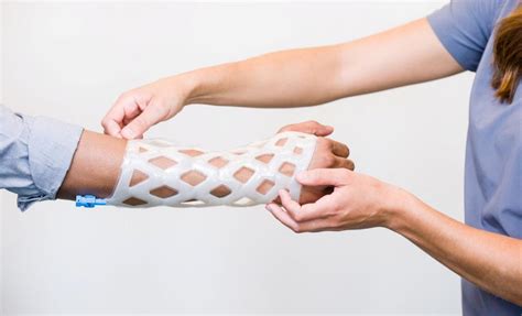 revolutionary  arm cast  waterproof breathable  itch