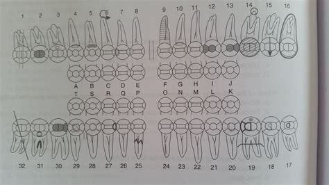 printable dental charting symbols vrogueco