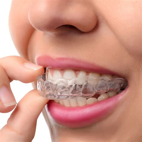 invisalign discomfort tips warsaw  pain relief orthodontic advice