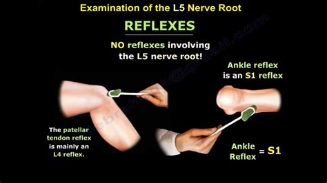 examination   nerve root orthopaedicprinciplescom