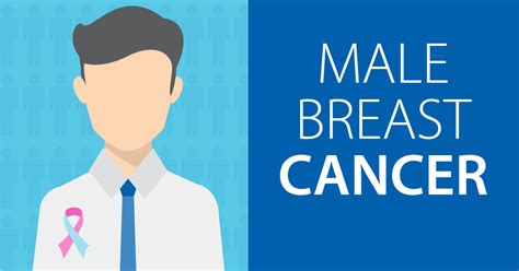 the difference male and female breast cancer ctca