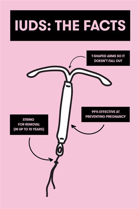 15 Questions Every Girl Has About Iuds — Answered