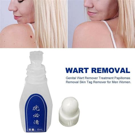 2965 skintag remover genital wart treatment removal mole and papilloma