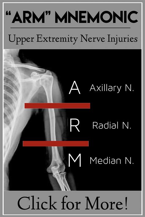 arm mnemonic  humerus fracture nerve injuries skeletal system