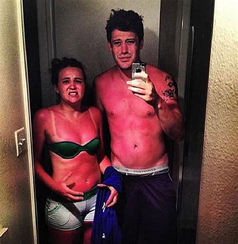Ouch 19 Of The Worst Sunburns And Tan Lines Ever
