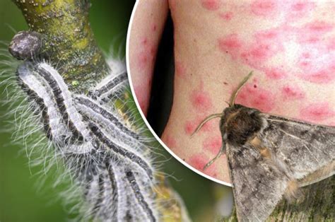 Toxic Insect Warning Britain To Face Swarm Of Poisonous Bugs Daily Star