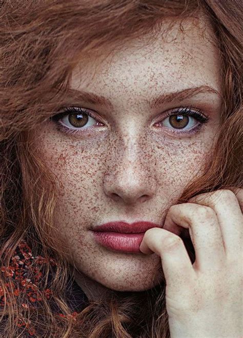 15 freckled people who ll hypnotize you with their unique beauty