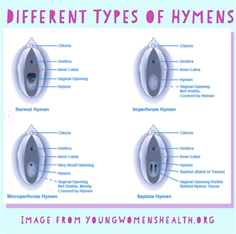 What Is The Hymen The Period Doctor