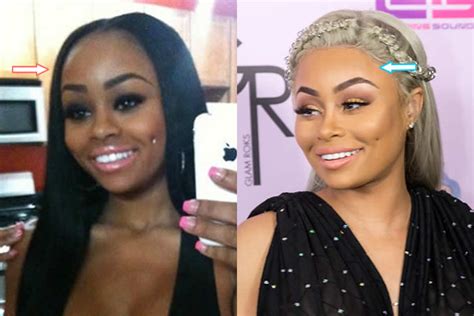 blac chyna plastic surgery exposed before and after photos
