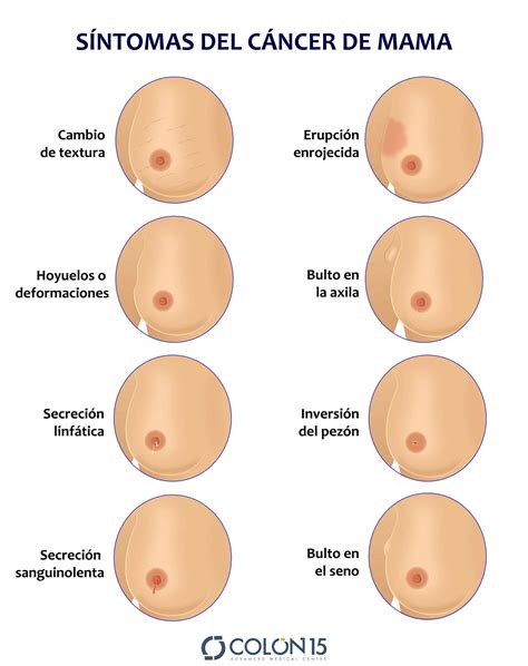 diagnóstico y seguimiento del cáncer de mama colón15