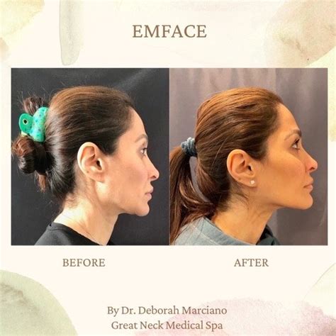great neck medical spa    reviews  middle neck
