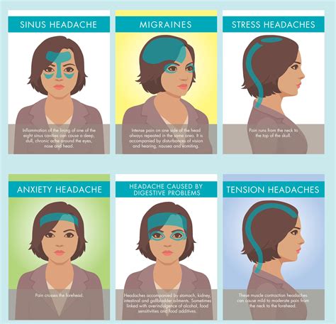 resize types  headaches milton chiropractic clinic