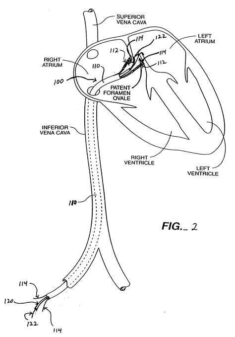 patent  energy based devices  methods  treatment  patent foramen ovale