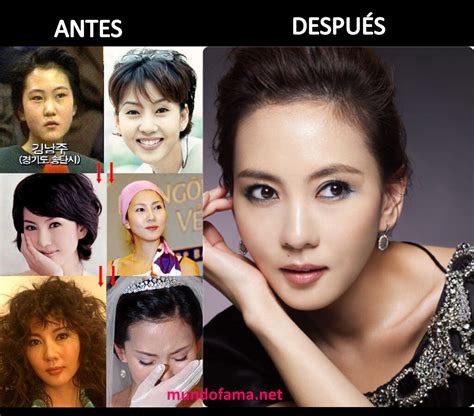 korean actress    plastic surgery actrices  flickr