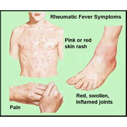 prepare  medical exams rheumatic fever long case study