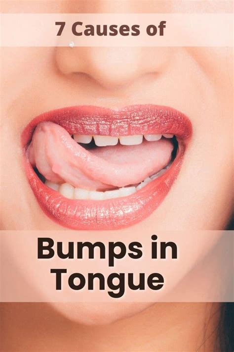 bumps  tongue archives medicogenius